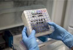 Przypadków będzie więcej, a leku nie ma. Jak leczyć małpią ospę?