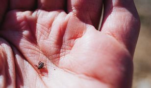 Odpowiednia dieta, sprawi, że kleszcze będą cię omijać? Wyjaśnijmy to raz na zawsze