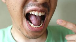 Cukrzycę poczujesz w ustach. Tego objawu nie lekceważ