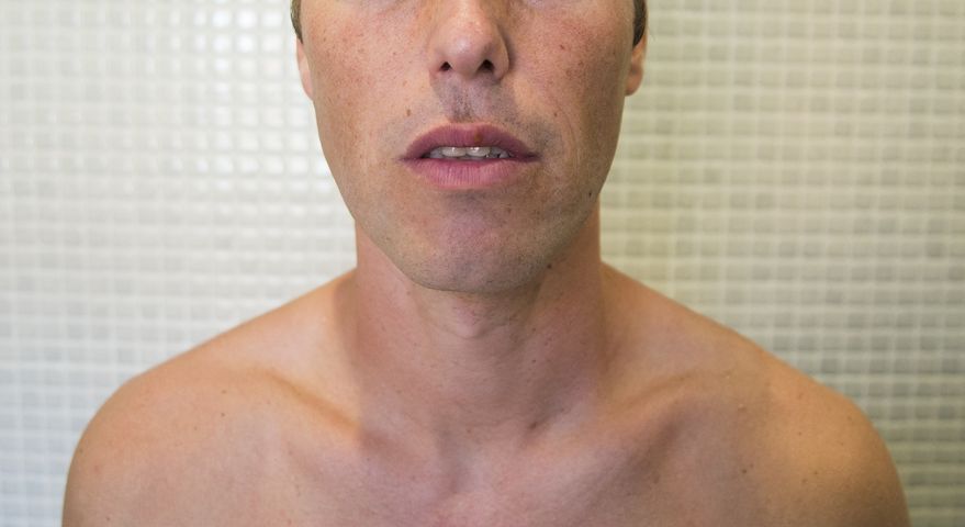 Rak jelita grubego może dawać przerzuty do jamy ustnej
