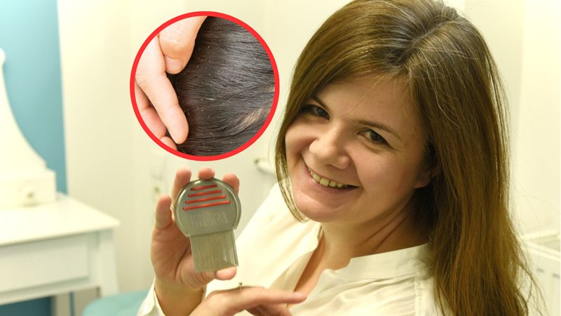 Ewa Kopeć, ekspertka od wszy. "Zdarzają się klasy, w których 70 proc. dzieci jest zawszonych"