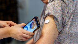 CGM to szansa dla pacjentów z cukrzycą. Nie każdy może korzystać z refundacji 