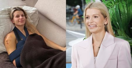 Dziennikarka TVN przeszła poważną operację po wypadku na stoku. "Mąż codziennie myje mi zęby, włosy, gotuje, karmi"