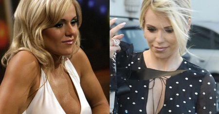 Doda zrezygnuje z implantów piersi? "Zaleca się je wymieniać co 15 lat"