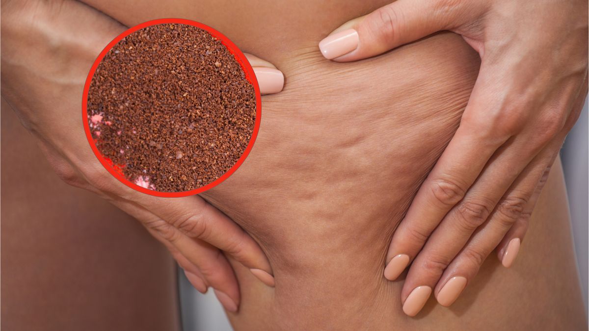 Jak pozbyć się cellulitu? 