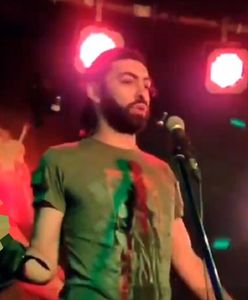 Makabryczne nagranie. Trzymał czaszkę Ukraińca na scenie