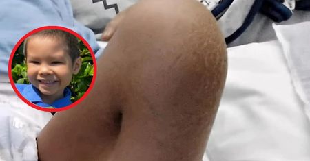 Znaleźli guzek na nodze 8-latka. Diagnoza ich zdruzgotała