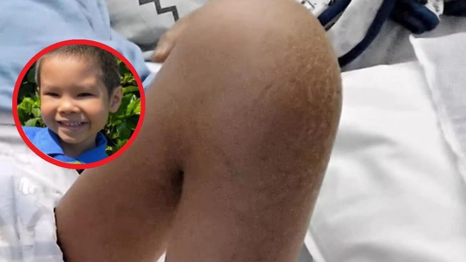 Znaleźli guzek na nodze 8-latka