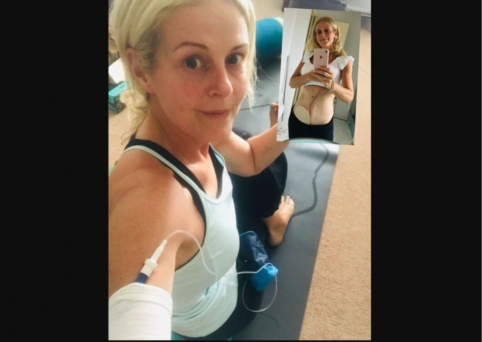 Po usłyszeniu diagnozy świat Kathy rozpadł się na kawałki 