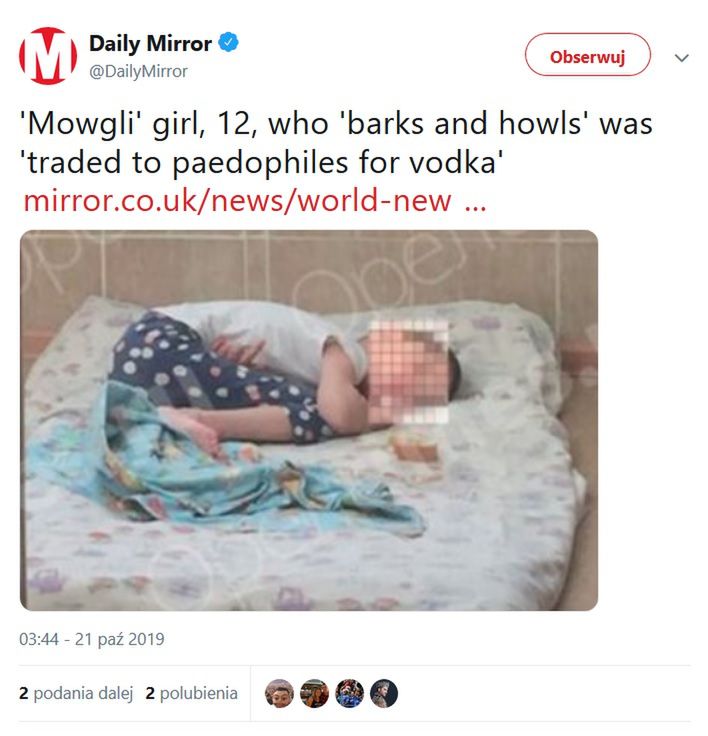 Dziewczynka nie umie normalnie chodzić, mówić ani jeść. Media nazwały ją &quot;Mowgli&quot;.