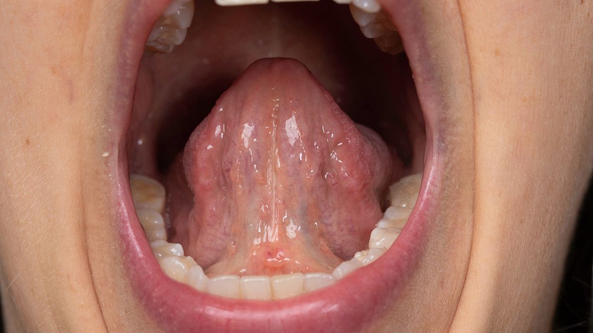 Jama ustna dzieli się na przedsionek i jamę ustną właściwą