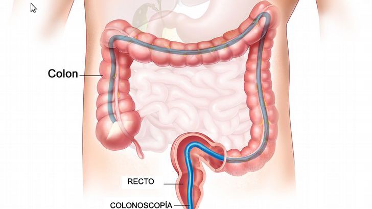 Amerykanie wolą kolonoskopię od sprzątania pod maską Windows 1