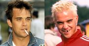 Robbie Williams wcierał kokainę w zęby. Dziś może się poszczycić wyjątkowym UZĘBIENIEM. Ładnie się prezentuje?