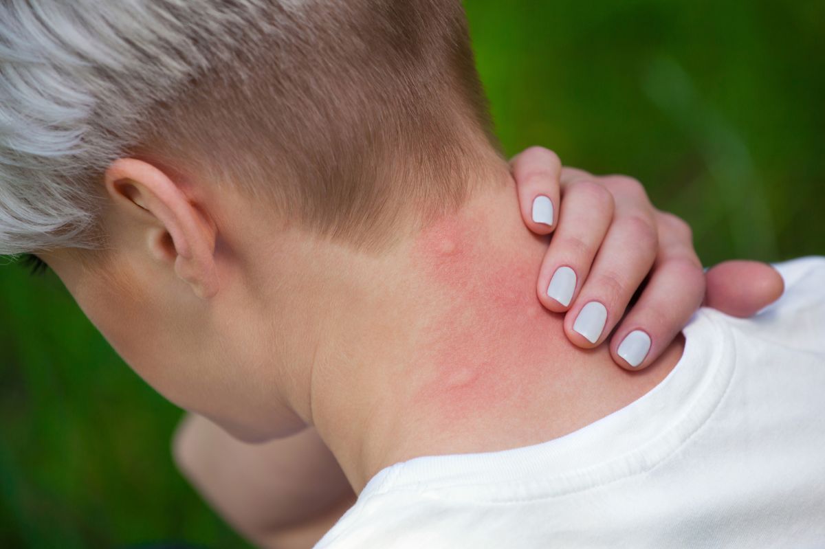 Natural defences: How to dodge mosquito bites this summer