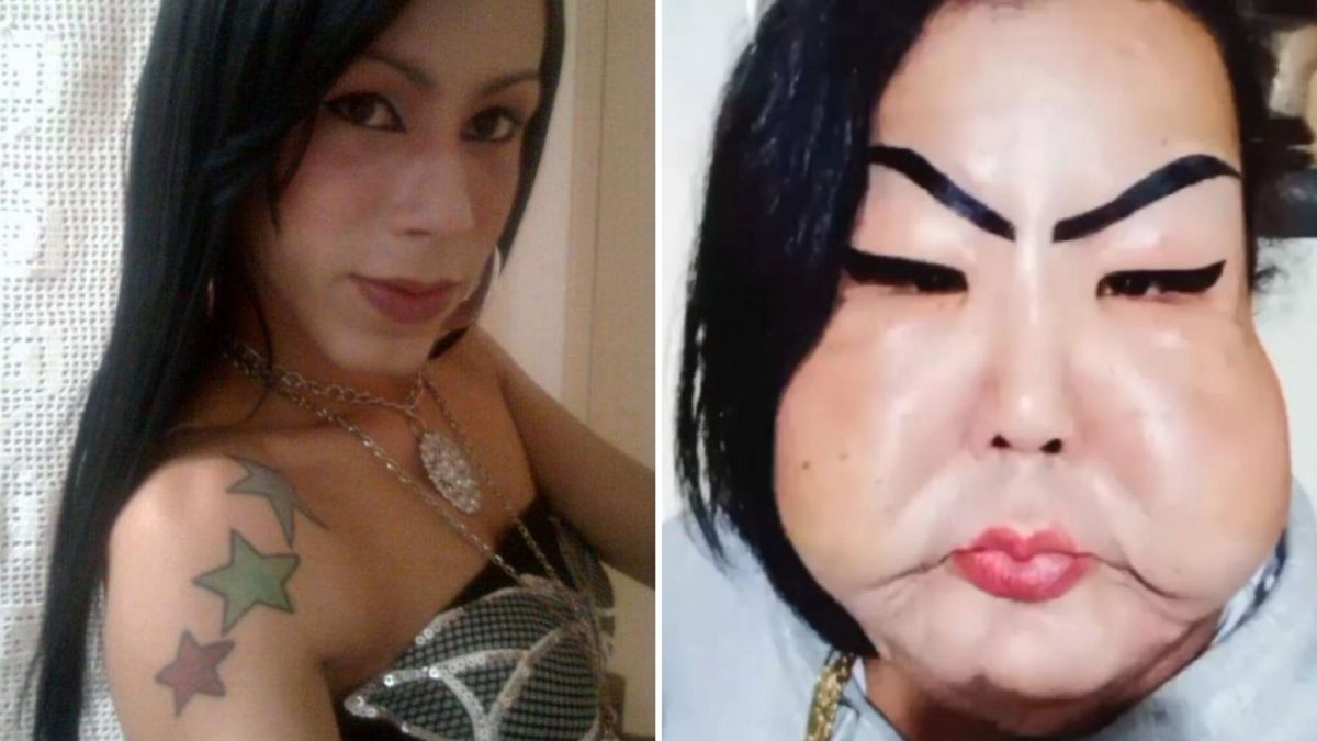 Juju Oliveira została oszpecona