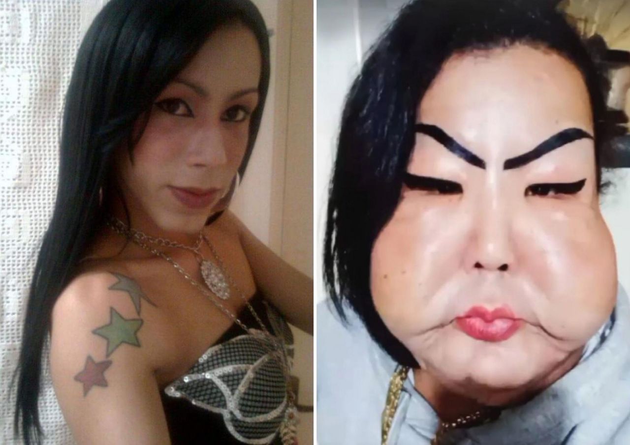 Juju Oliveira chciała poprawić wygląd twarzy. W jej policzki wstrzyknięto silikon