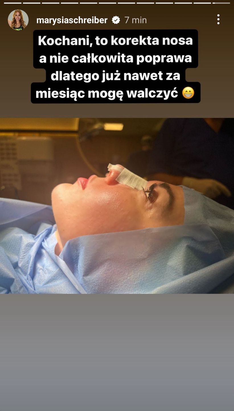 Marianna Schreiber przeszła korektę nosa
