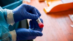 PKO Ekstraklasa. Koronawirus w Wiśle Płock. Zakażony piłkarz czuje się dobrze