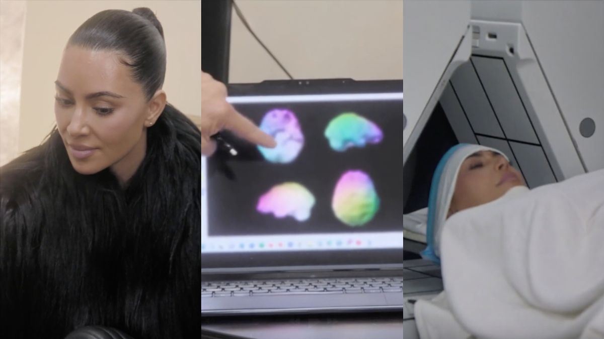 Kim Kardashian ma luki w mózgu