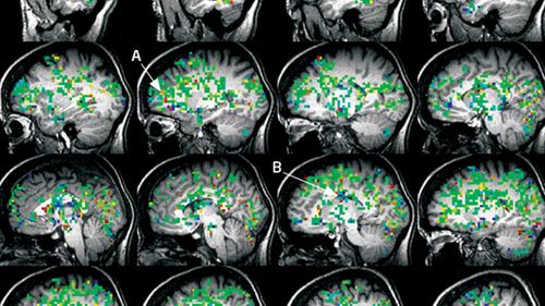 Orgazm otwiera nowe stany świadomości? Tak twierdzą naukowcy 1