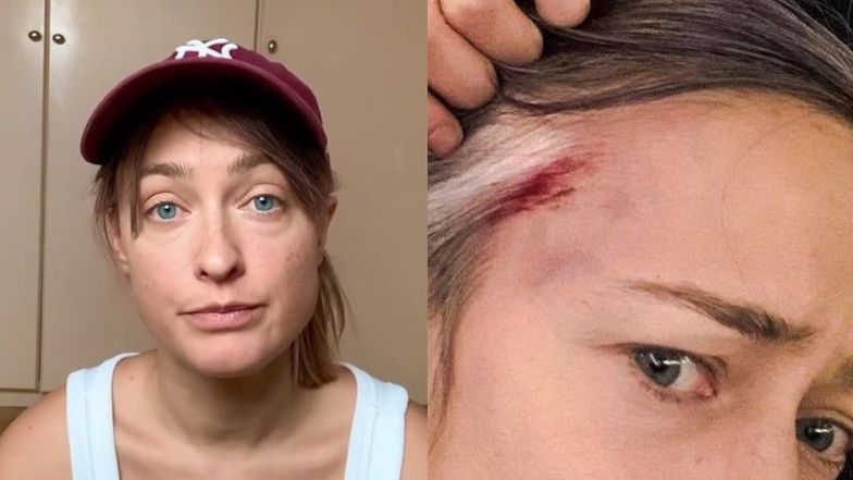 Matylda Damięcka uderzona przez policjanta