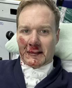 Makabryczny wypadek prezentera TV. Życie zawdzięcza jednej rzeczy