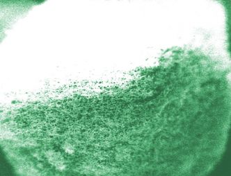 Gąbki z insuliną zastąpią nieprzyjemne zastrzyki?