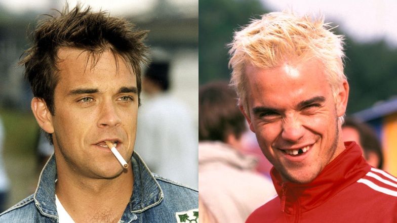 Robbie Williams has brought his teeth to a deplorable state.