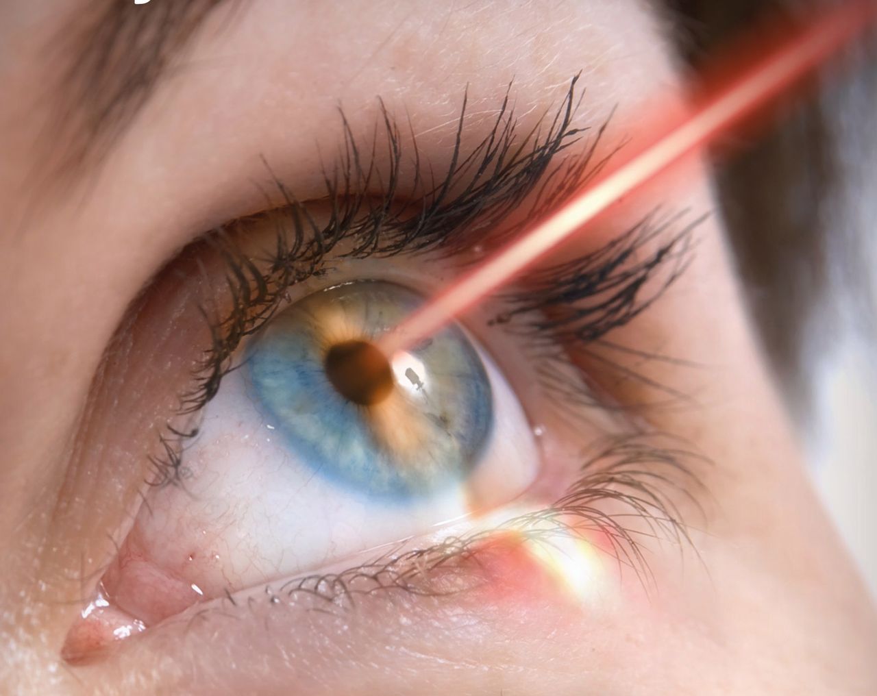 Laser skierowany na oko może być niebezpieczny