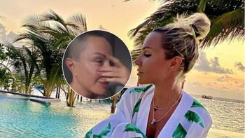Blanka Lipińska mogła stracić wzrok. "Pies rozszarpał mi pół twarzy". Wraca do tragedii