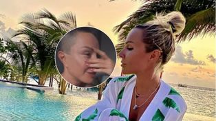 Blanka Lipińska mogła stracić wzrok. "Pies rozszarpał mi pół twarzy". Wraca do tragedii