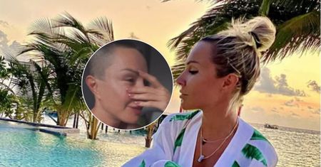 Blanka Lipińska mogła stracić wzrok. "Pies rozszarpał mi pół twarzy". Wraca do tragedii
