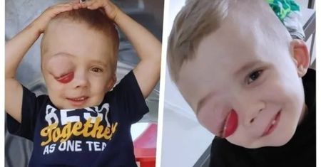 Gigantyczny guz w główce Szymka. Ratunek za miliony