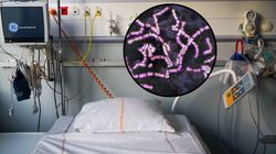 Rzadkie powikłanie po paciorkowcach. Krostki pokryły dłonie mężczyzny