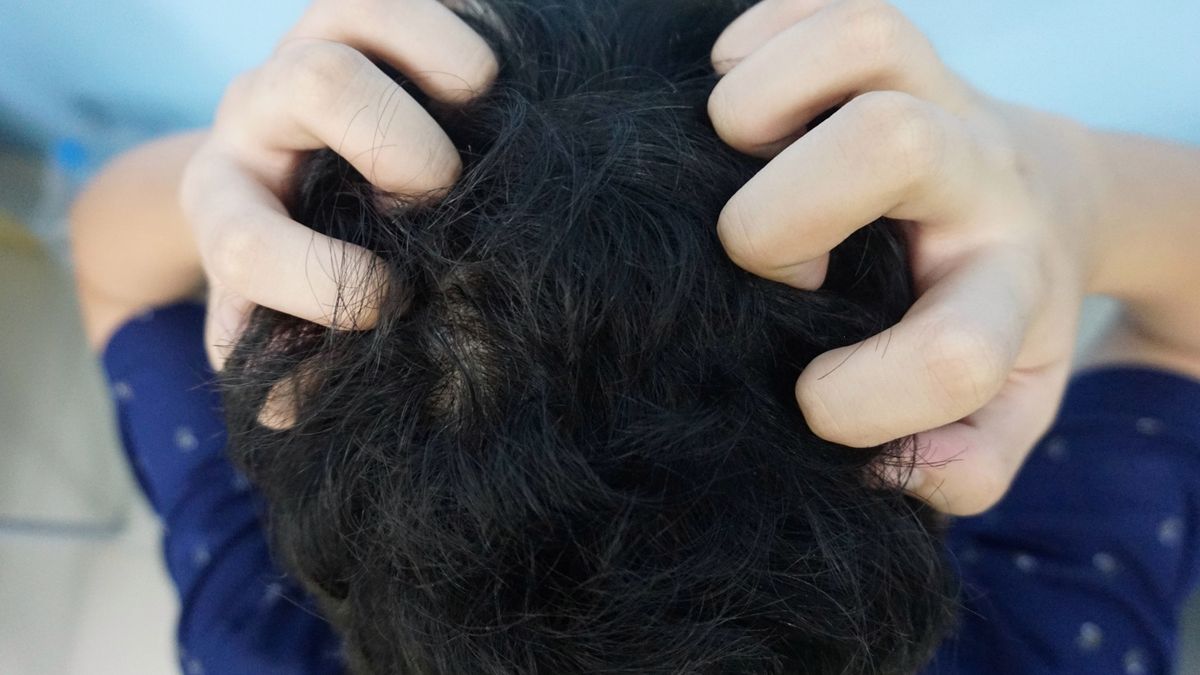 Swędzenie skóry głowy