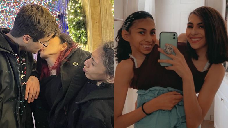 Jedna ma chłopaka, druga jest aseksualna. 22-letnie bliźniaczki syjamskie wyznają, jak wygląda ich ŻYCIE MIŁOSNE