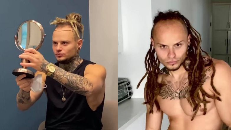 Mateusz Janusz chwali się efektami zabiegu