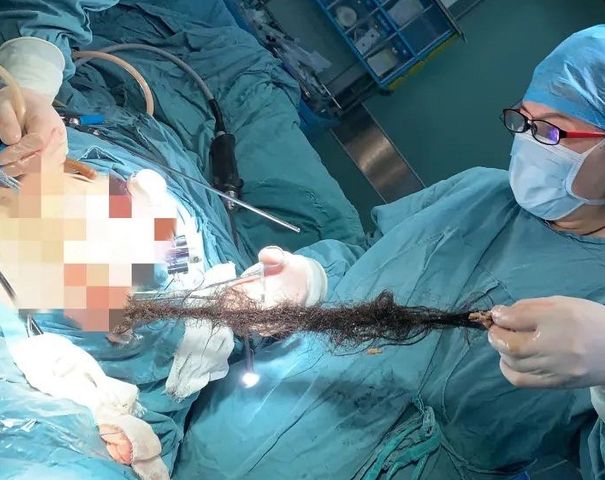 Niecodzienną operację przeprowadzili lekarze z Wuhan