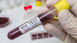 Przełom w badaniach nad HIV. Odkryto, jak wirus integruje się z DNA człowieka