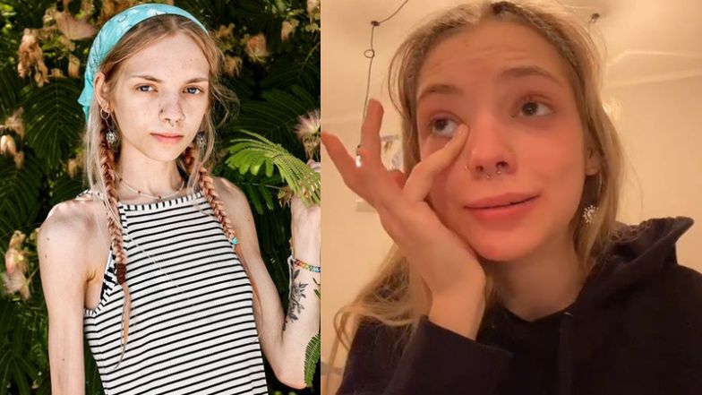 18-letnia Ola walczy z anoreksją na TikToku!