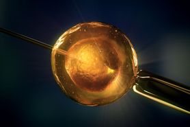 Gwiazdy, które skorzystały z in vitro