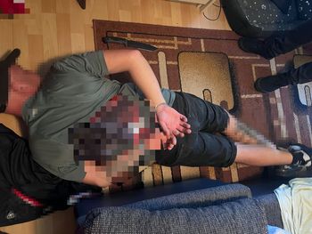 Zaatakowali, bo miał klubowy szalik. Nastolatek trafił do szpitala