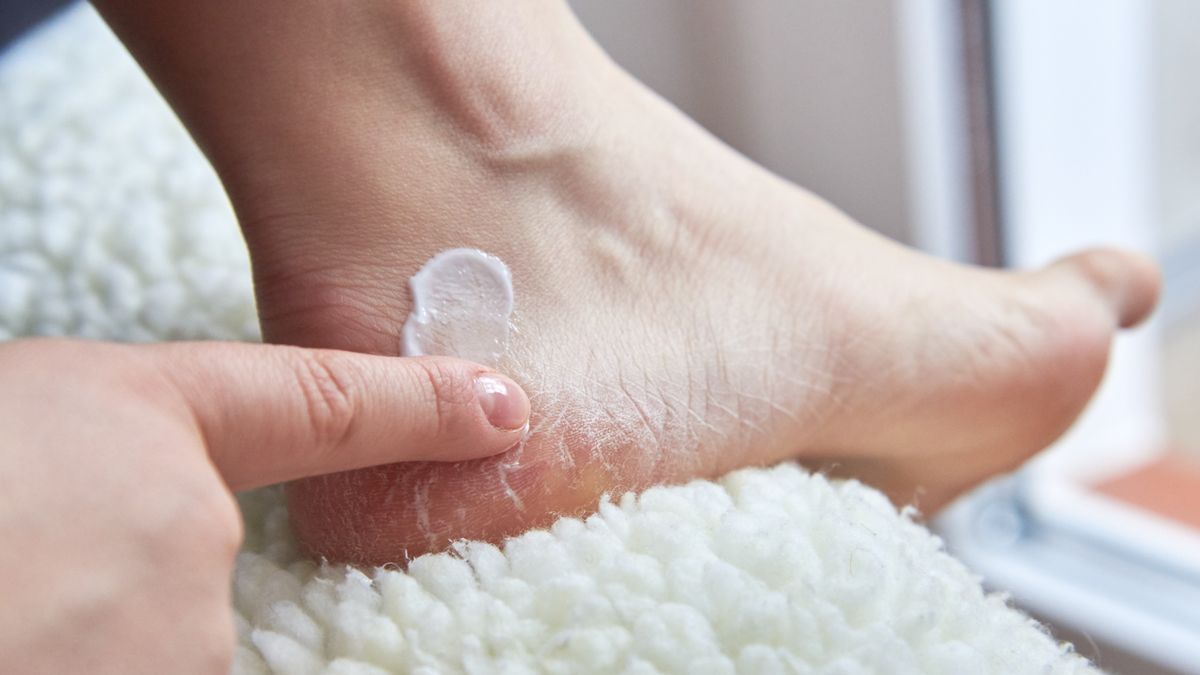 Na suche pięty pomoże m. in. peeling z sody oczyszczonej