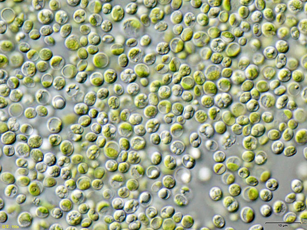 Algi pod mikroskopem.