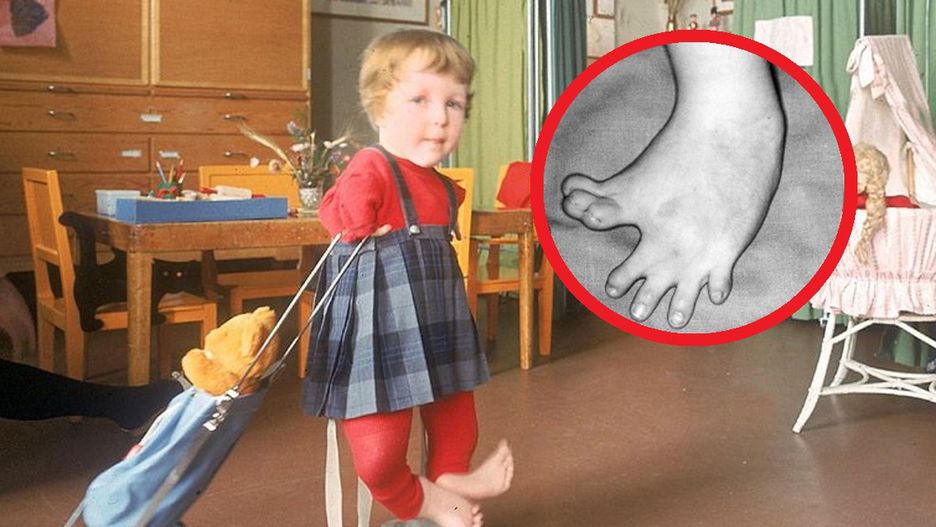 Australia wystosuje przeprosiny. Chodzi o ofiary "tragedii talidomidu"