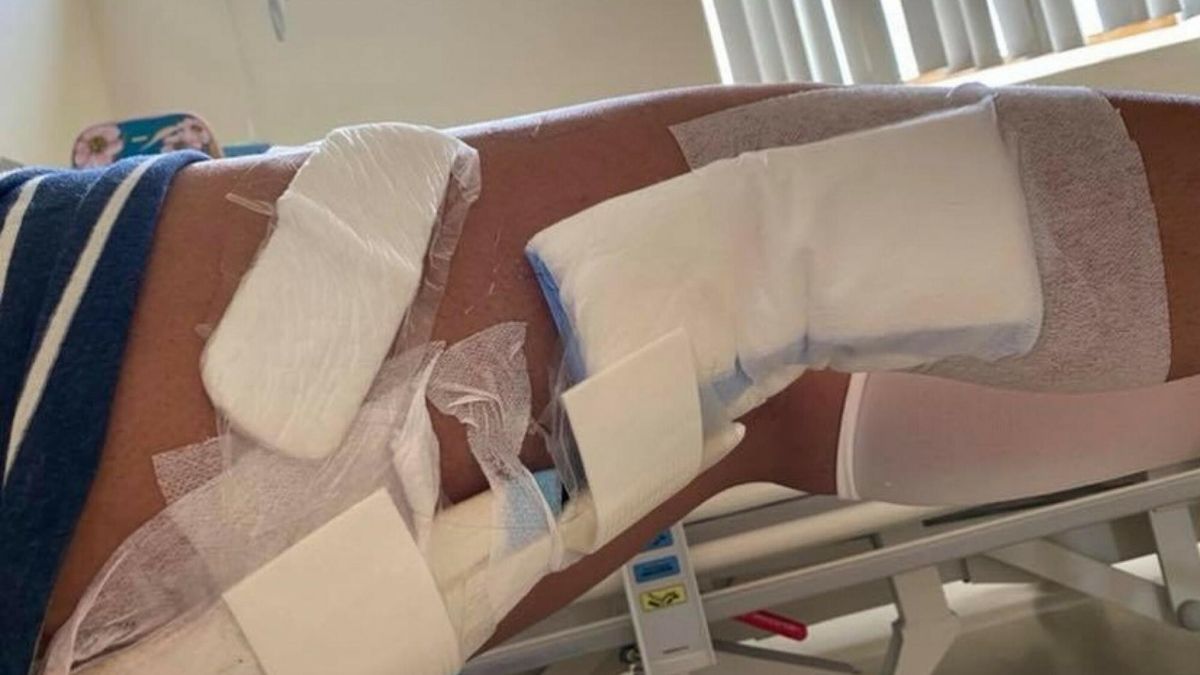 U Geety zdiagnozowano mięsaka pęcherzykowego