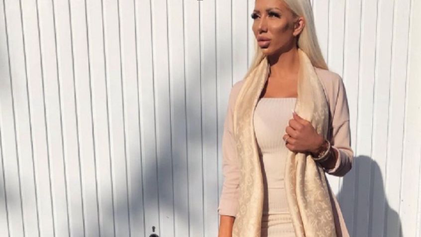 "Charlie Barbie" leczy się z kompleksów operacjami plastycznymi. Finansuje je mąż 