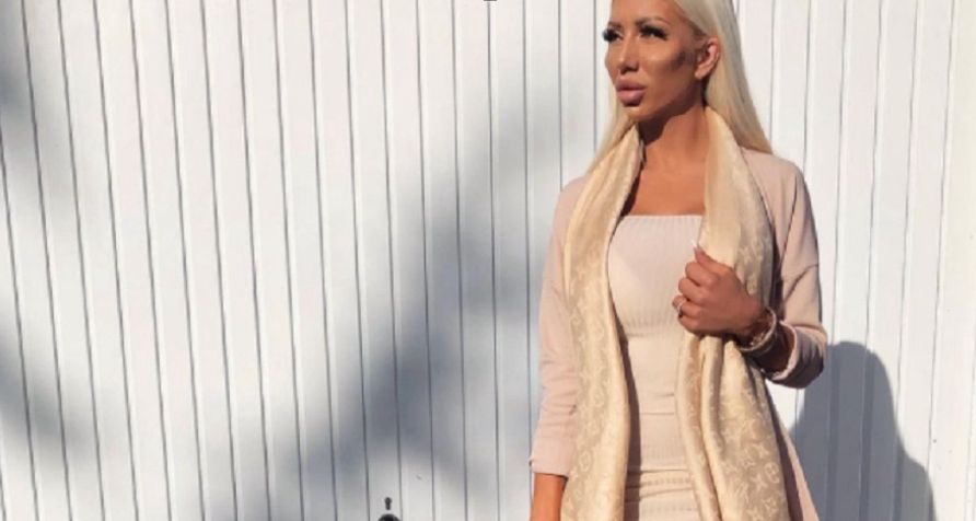 "Charlie Barbie" leczy się z kompleksów operacjami plastycznymi. Finansuje je mąż