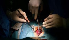 Zamiast CV przesłał "swoje wnętrzności". Czy nietypowa rekrutacja przeszłaby w Polsce?