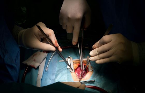 Zamiast CV przesłał "swoje wnętrzności". Czy nietypowa rekrutacja przeszłaby w Polsce?